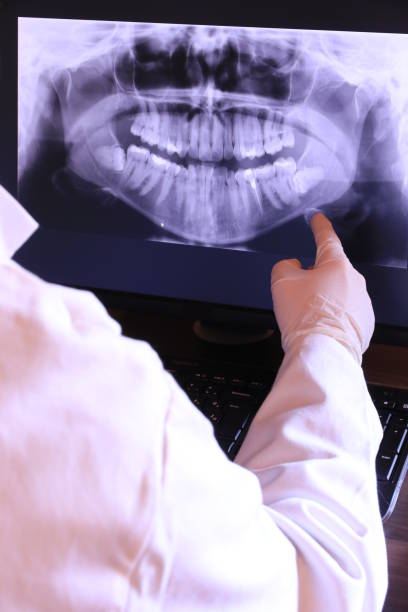 Best Emergency Tooth Extraction in Irondale, GA
