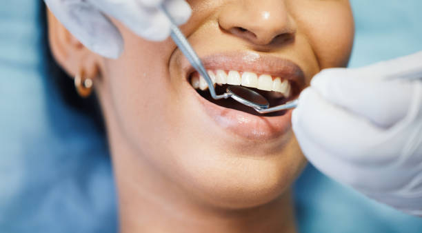 Best Emergency Root Canal Treatment in Irondale, GA
